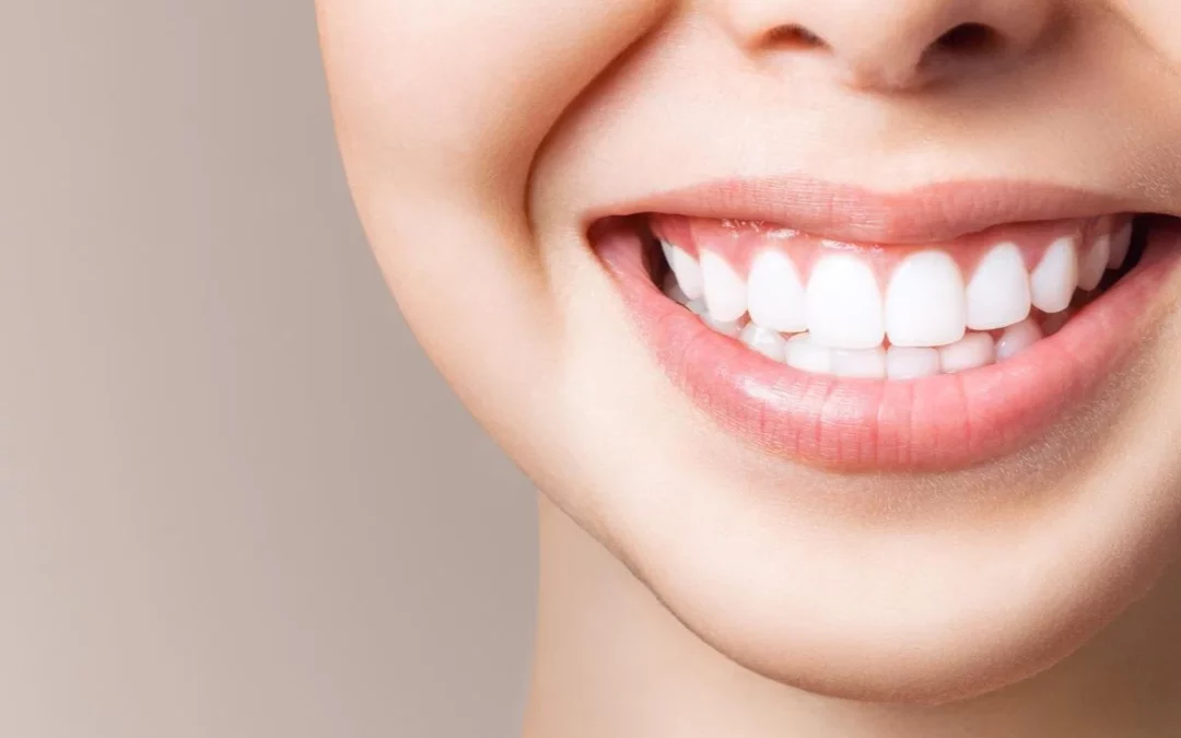 What Process Does A Dentist Use To Whiten Teeth?